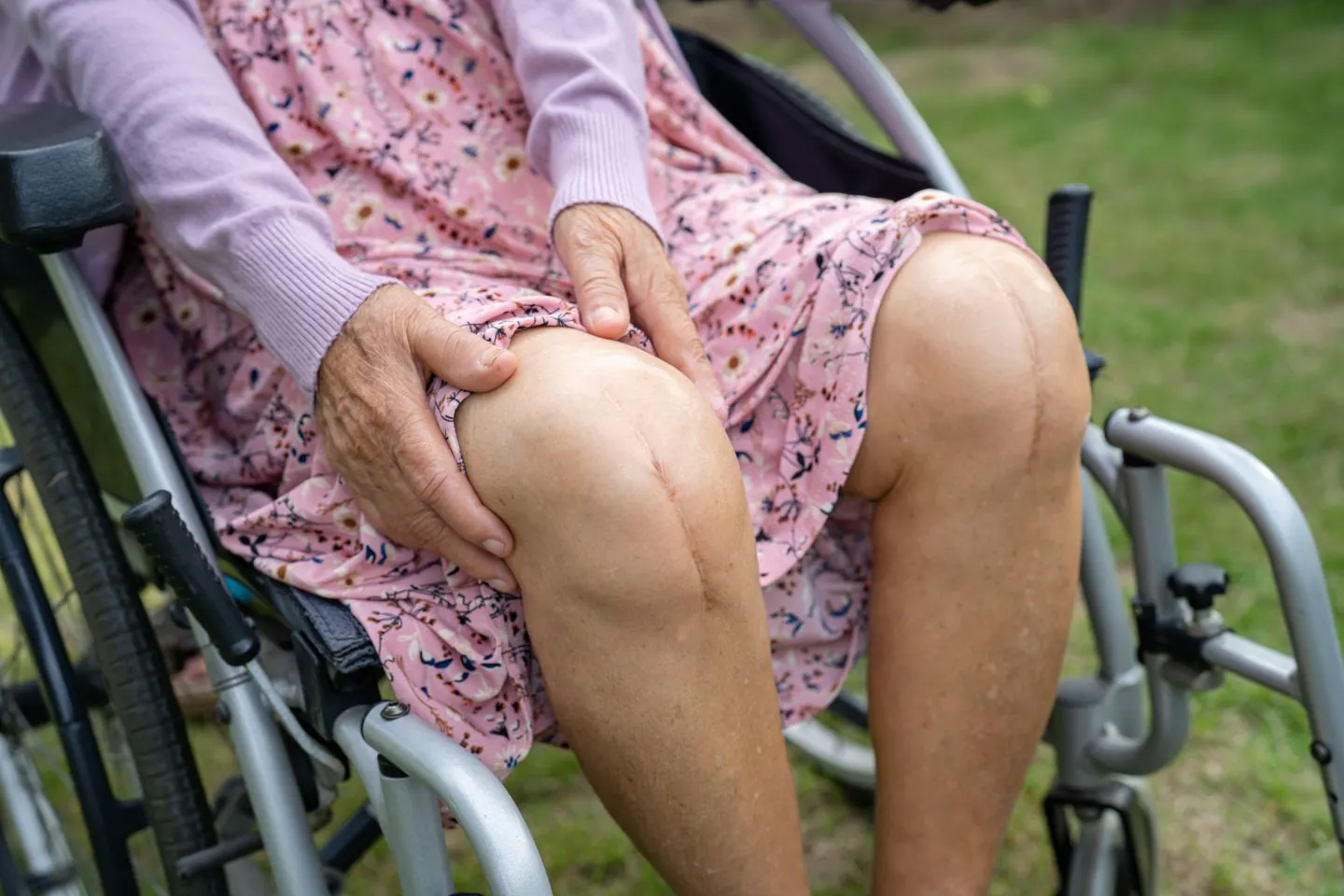 Knee Replacement Surgery