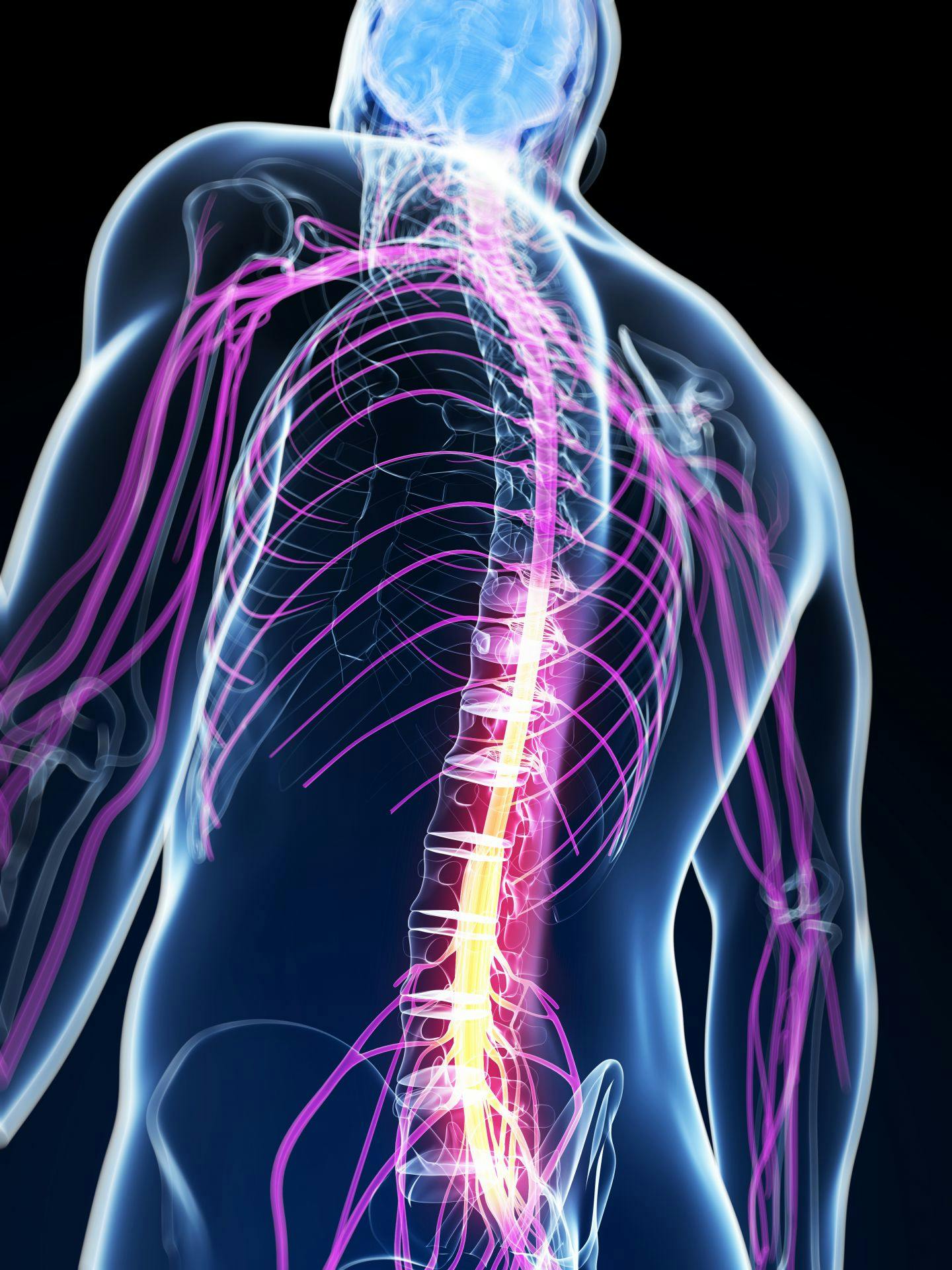 Skeletal view of low back pain