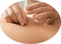 Physiotherapy New Westminster BC