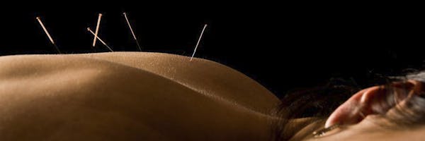Acupuncture | West Hills CA