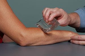 A physical therapist applying an ice cube to the forearm of a patient