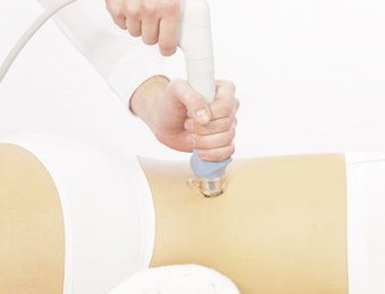 Radial Pressure Wave Therapy | RPW