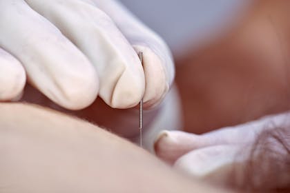 PRO Physical Therapy Dry Needling
