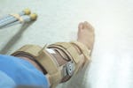 Knee brace post knee surgery