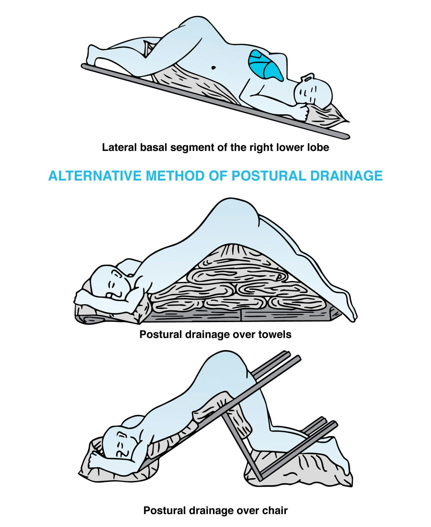 Postural Drainage Positions