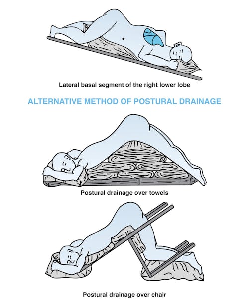 Postural Drainage Positions