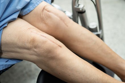 physical therapy Oshawa ON