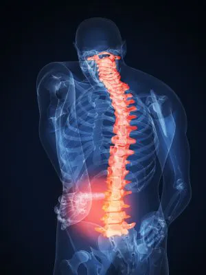 Sciatica Relief