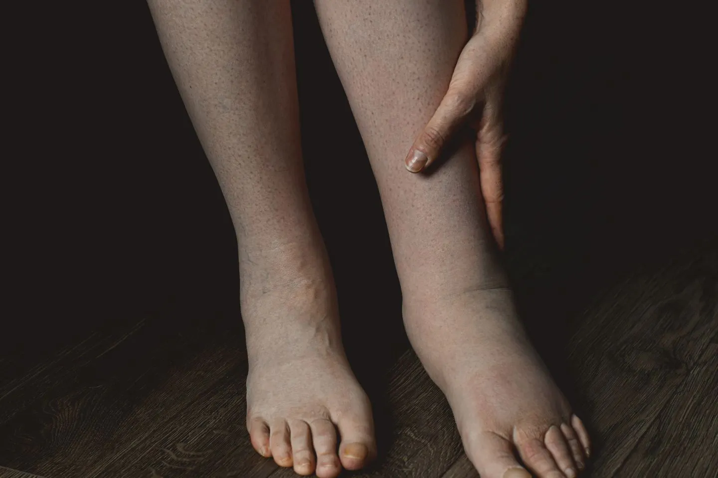 physiotherapy Edmonton Alberta