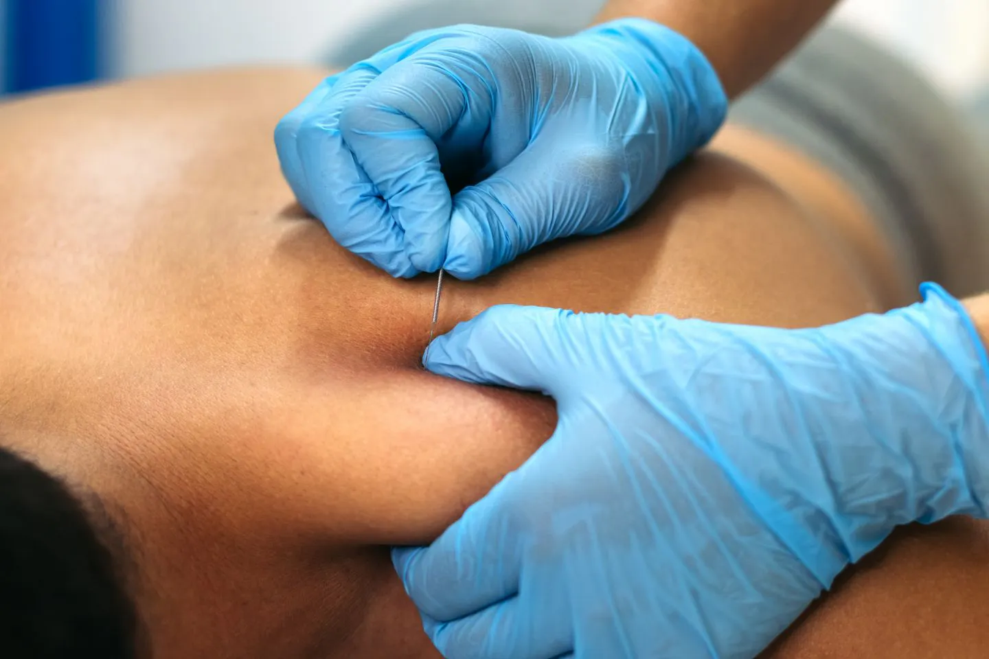 physical therapy Ferriday LA
